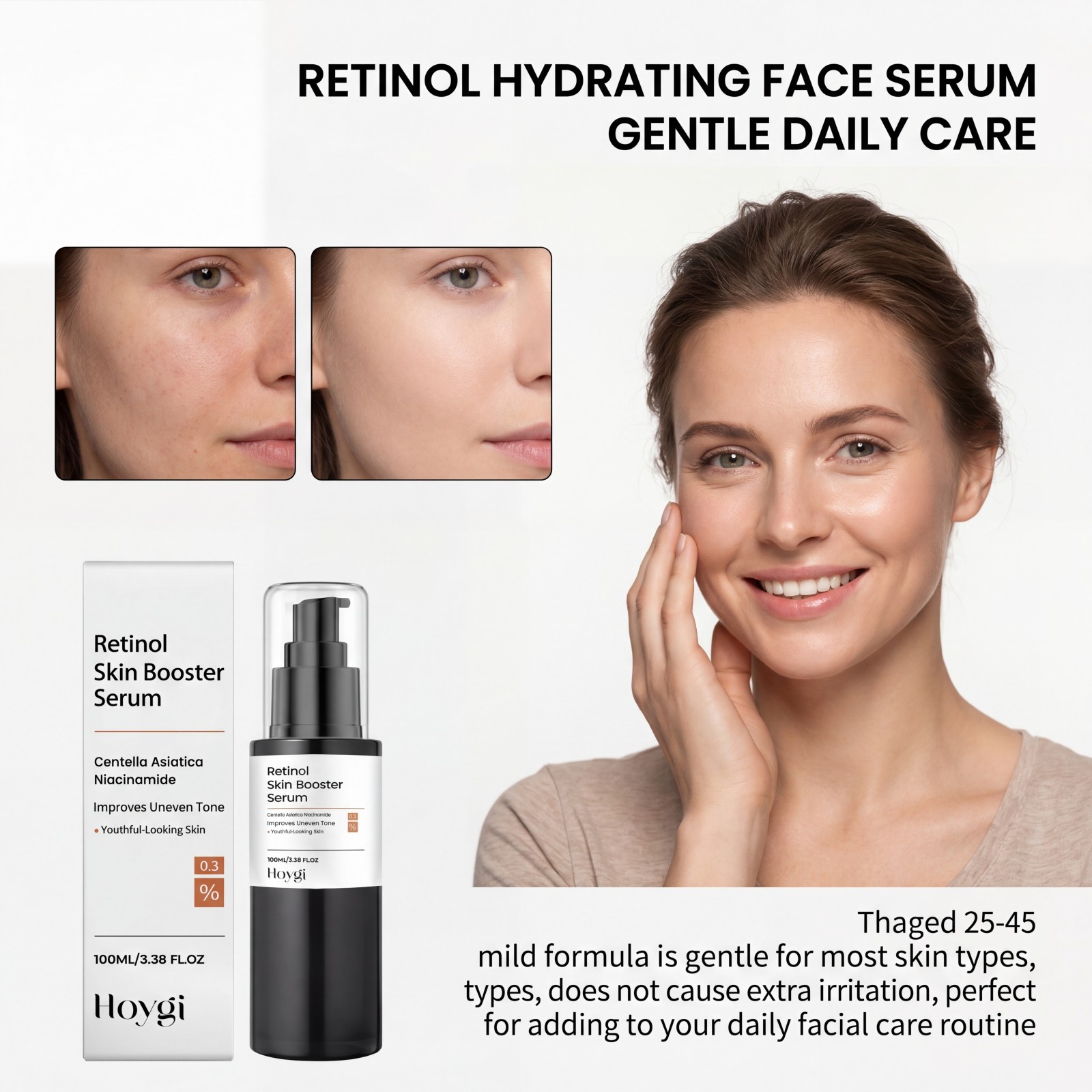 100ml Retinol Hautpflege-Boost – The Ordinary Serum Hyaluronic Acid Bewertung und Preis